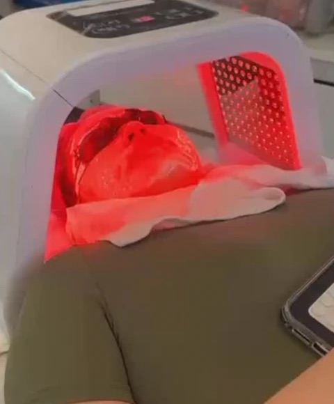 Terapia facial con luz LED roja
